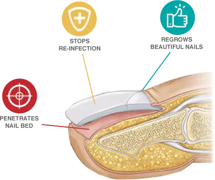 NailLuxe™ Nail Repair Formula